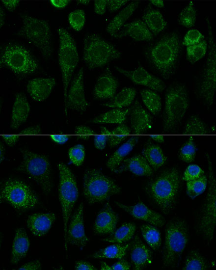 NDUFAB1 Rabbit Polyclonal Antibody