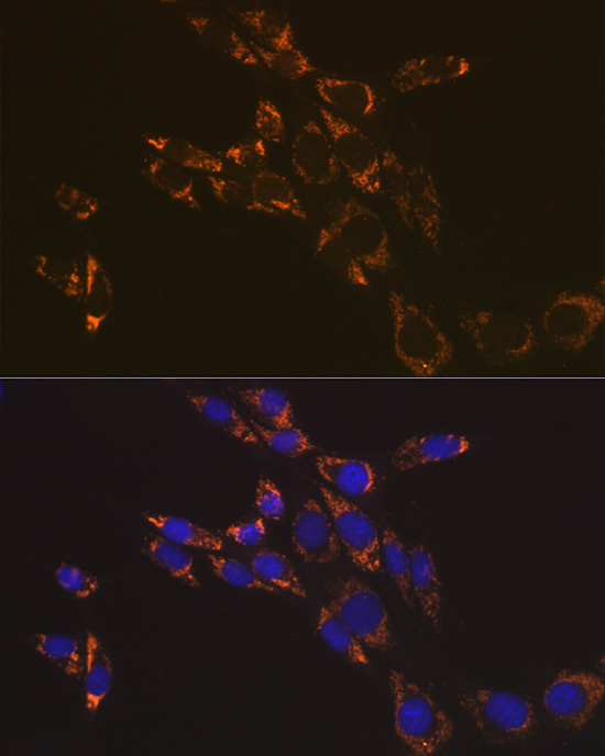 RNF126 Rabbit Polyclonal Antibody