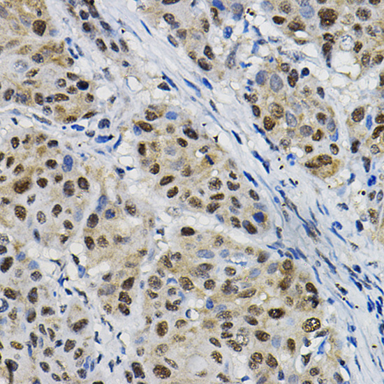 DNAJC17 Rabbit Polyclonal Antibody