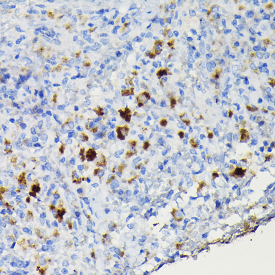 CCR3 Rabbit Polyclonal Antibody