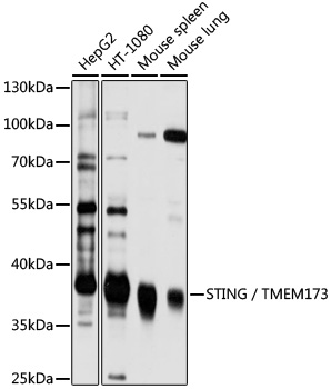 STING / TMEM173 Rabbit Polyclonal Antibody
