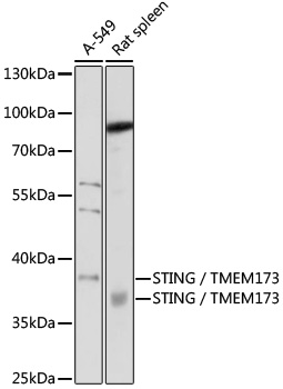 STING / TMEM173 Rabbit Polyclonal Antibody