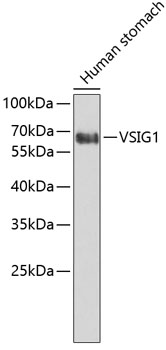VSIG1 Rabbit Polyclonal Antibody
