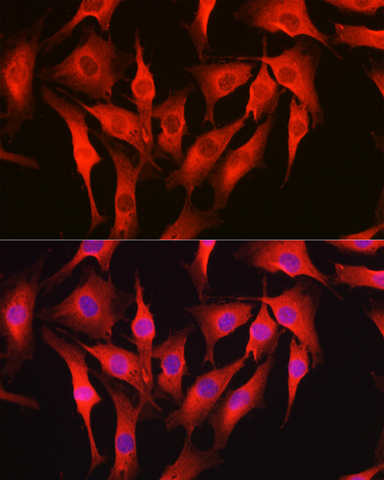 TMBIM1 Rabbit Polyclonal Antibody