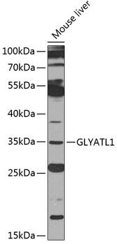 GLYATL1 Rabbit Polyclonal Antibody