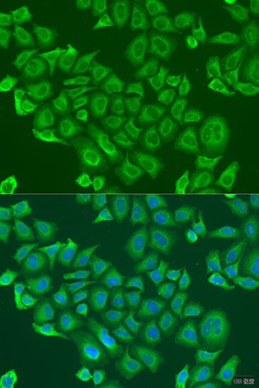 GLYATL1 Rabbit Polyclonal Antibody
