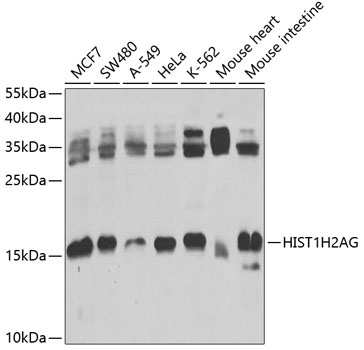 Histone H2A.1 Rabbit Polyclonal Antibody