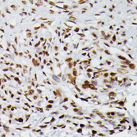 HIST1H2BG Rabbit Polyclonal Antibody