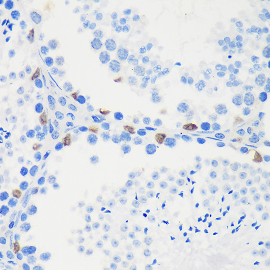 LARP1B Polyclonal Antibody