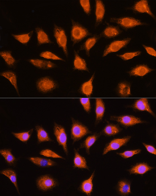 GNAI3 Polyclonal Antibody