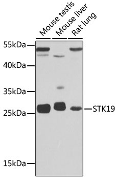 STK19 Polyclonal Antibody
