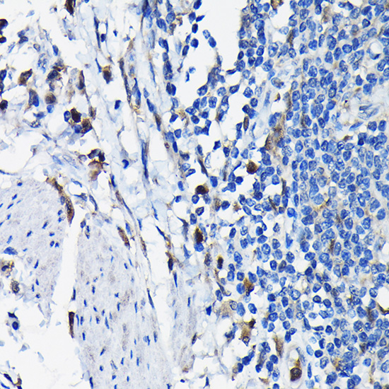 STK19 Polyclonal Antibody