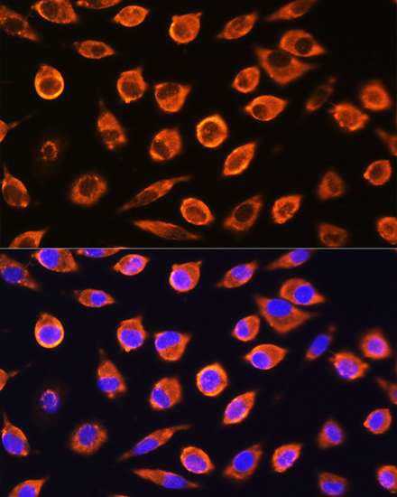 RND1 Polyclonal Antibody