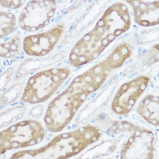 NDUFB4 Polyclonal Antibody