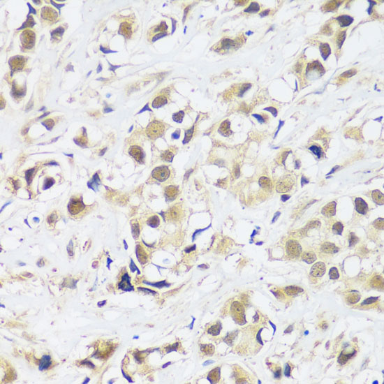 ASCL4 Polyclonal Antibody