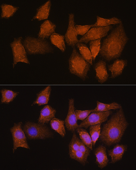 NMNAT3 Polyclonal Antibody