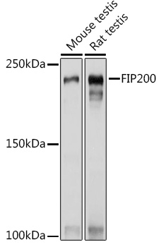 RB1CC1 Polyclonal Antibody