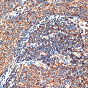 RB1CC1 Polyclonal Antibody