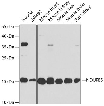 NDUFB5 Polyclonal Antibody