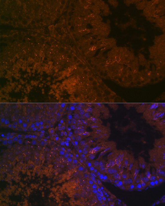 BACE2 Polyclonal Antibody