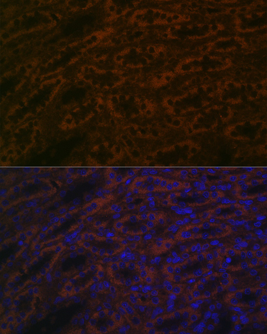 BACE2 Polyclonal Antibody
