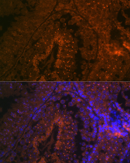 BACE2 Polyclonal Antibody