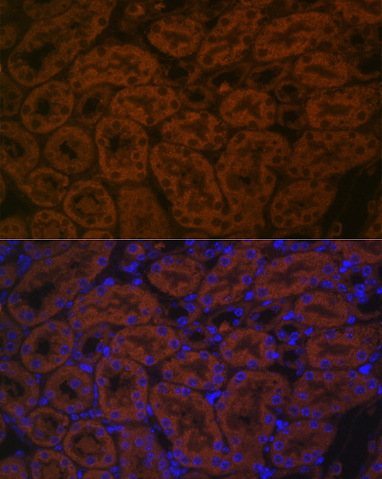 BACE2 Polyclonal Antibody