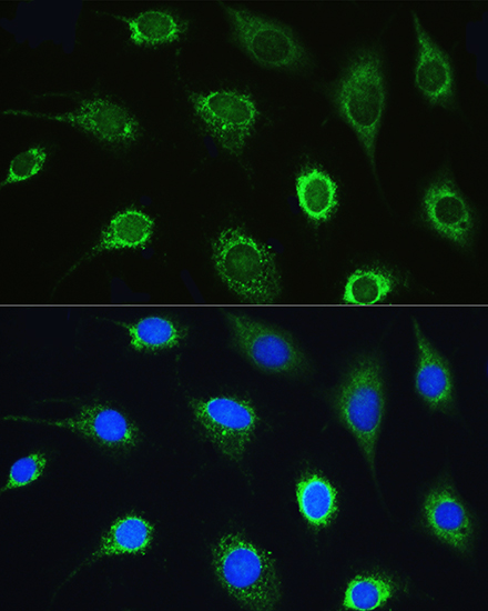 LARS Polyclonal Antibody
