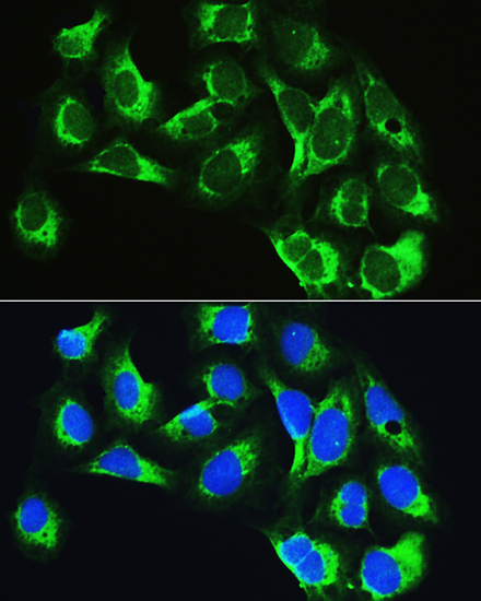 LARS Polyclonal Antibody