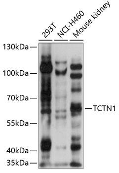 TCTN1 Polyclonal Antibody