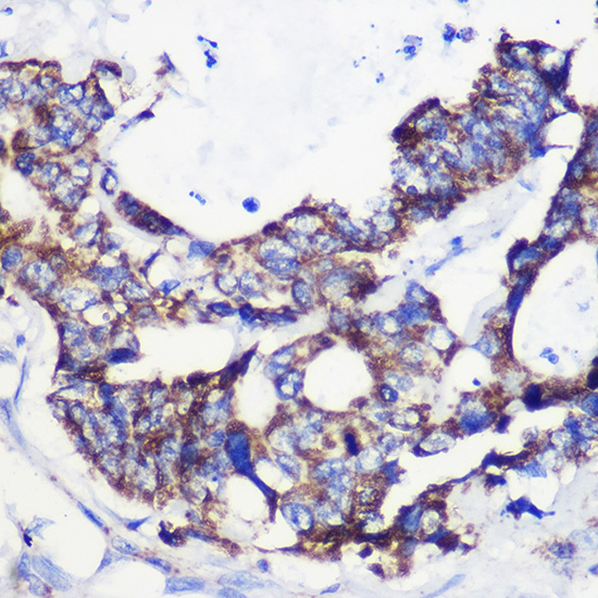 ACSS1 Polyclonal Antibody