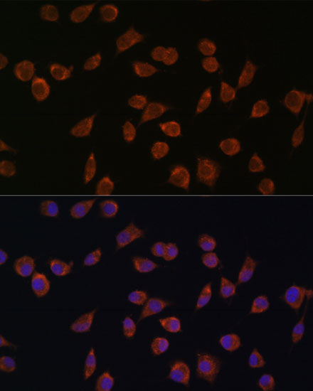 ACSS1 Polyclonal Antibody