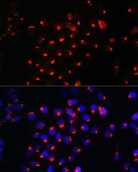 SGMS1 Polyclonal Antibody