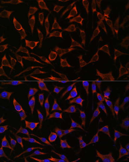 SEPT8 Polyclonal Antibody