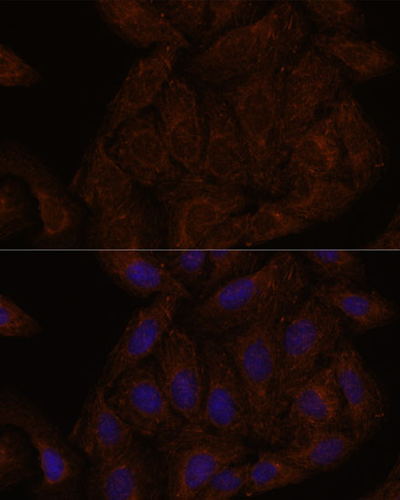SEPT8 Polyclonal Antibody