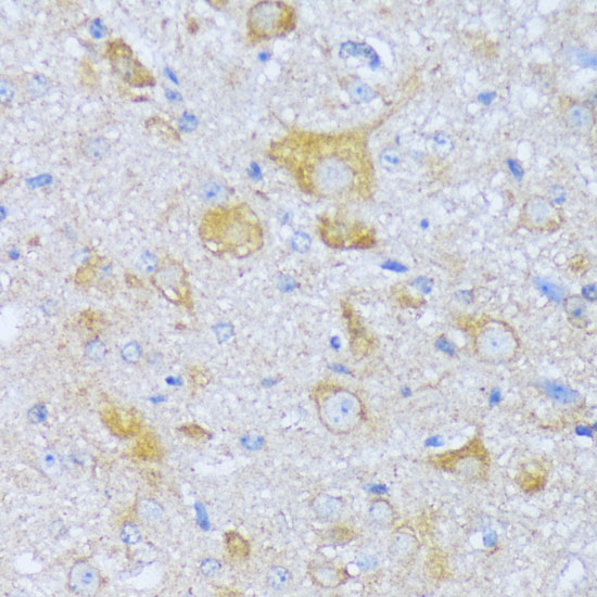 ACADSB Polyclonal Antibody