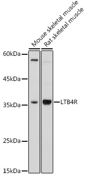 LTB4R Polyclonal Antibody