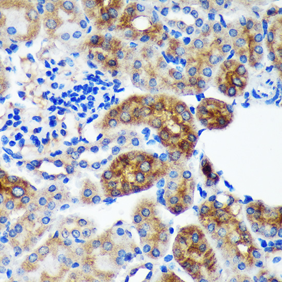 PYCR2 Polyclonal Antibody