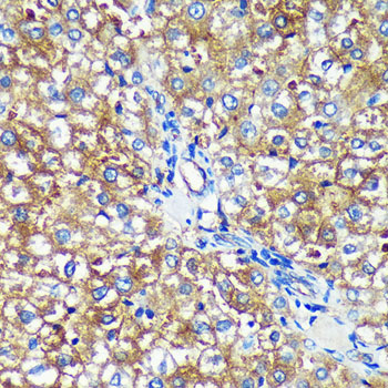 PYCR2 Polyclonal Antibody