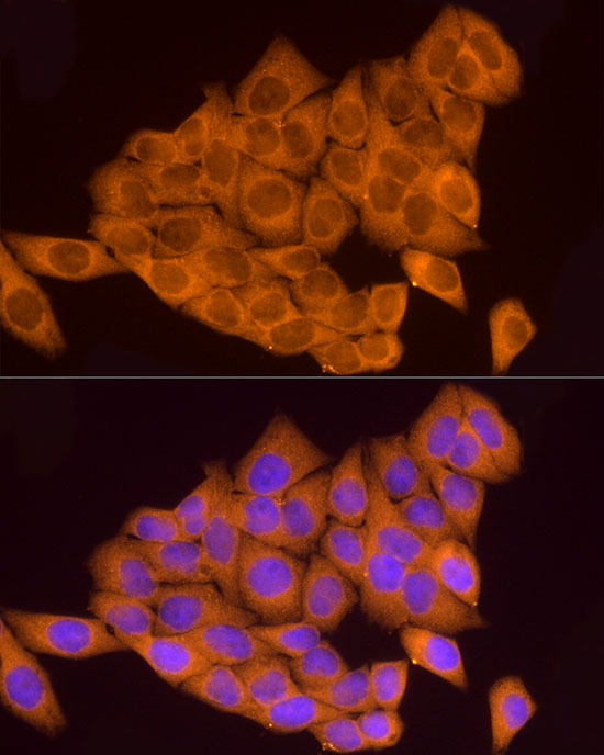 ATP6V0A1 Polyclonal Antibody