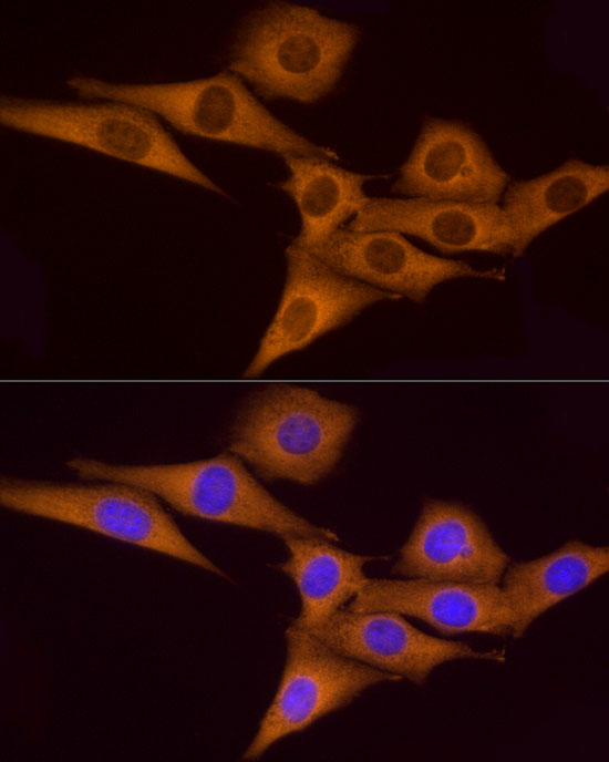 ATP6V0A1 Polyclonal Antibody