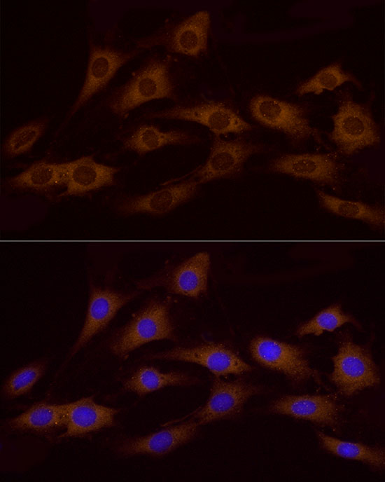 ATP6V0A1 Polyclonal Antibody