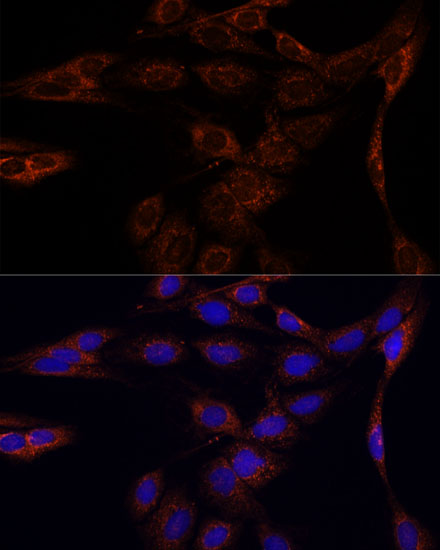 PFDN4 Polyclonal Antibody