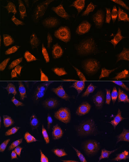 PFDN4 Polyclonal Antibody
