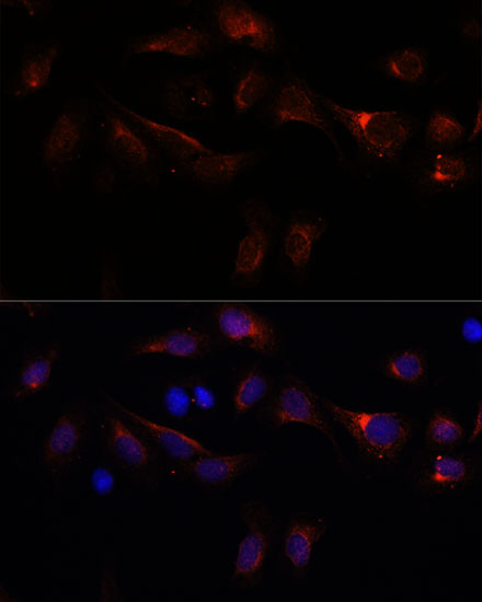 PFDN4 Polyclonal Antibody