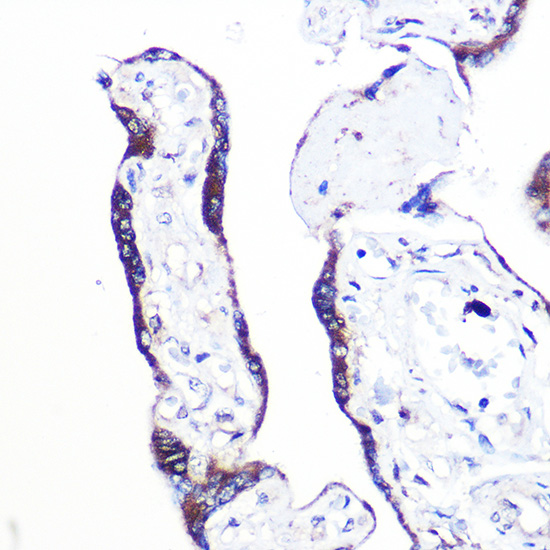 PEX2 Polyclonal Antibody