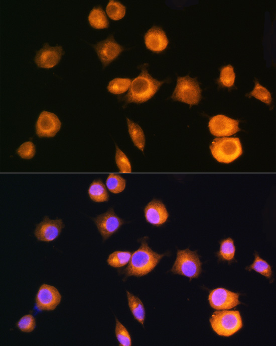 PRKAR2A Polyclonal Antibody