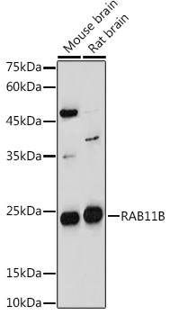 RAB11B Polyclonal Antibody