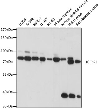 TCIRG1 Polyclonal Antibody