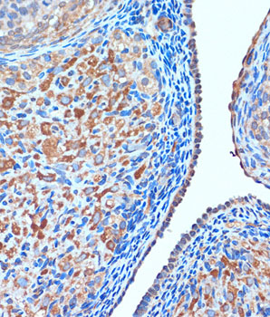 TCIRG1 Polyclonal Antibody